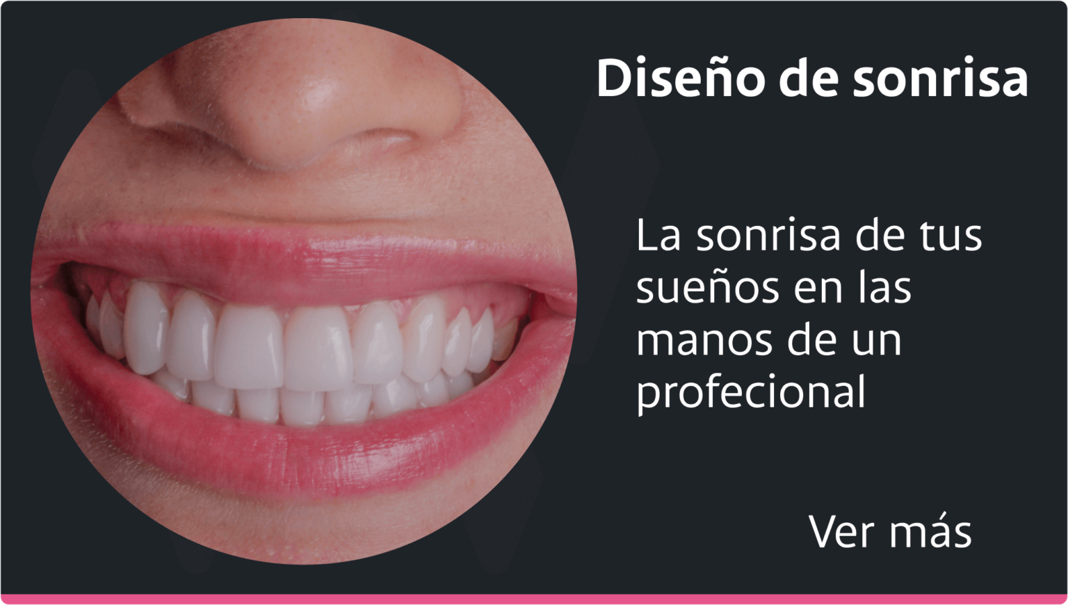 diseno-dental