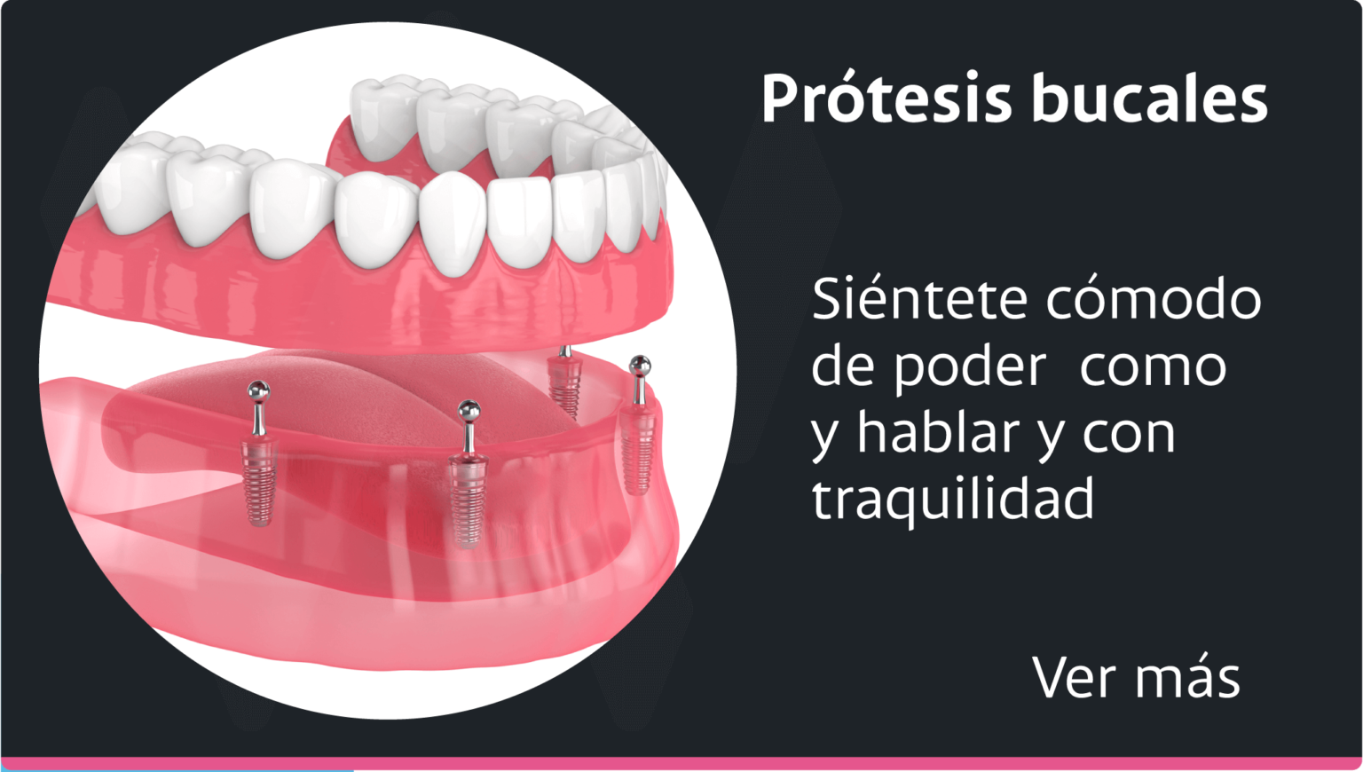 protesis-dental